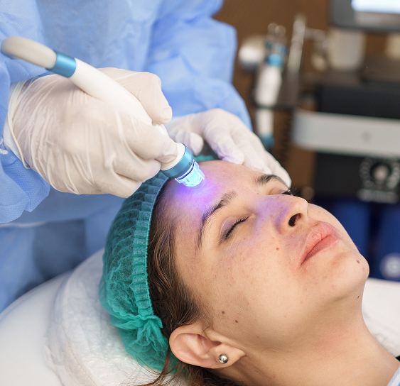 Facial Rejuvenation